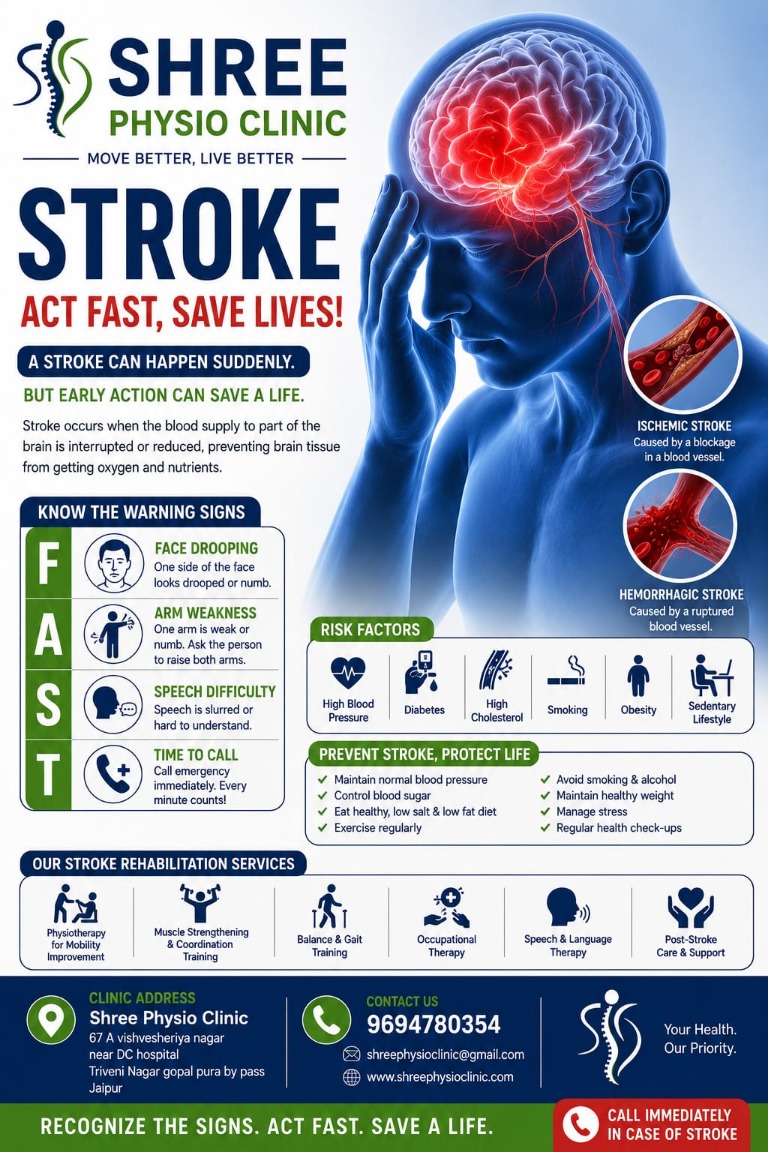 Stroke Rehabilitation